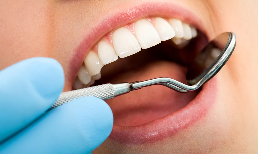 Dental check up teeth-mouth